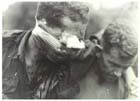 A badly wounded soldier of the Australian 2/2nd Battalion is helped into a jeep ambulance after having to walk five miles to reach the Advanced Dressing Station.  The wounded often had no choice but to endure such hardships thanks to the inhospitable terrain encountered, particularly in the mountains. The Japanese faced even greater difficulties than the Australians in this regard and their wounded and sick had only the smallest chance of surviving their ordeal.